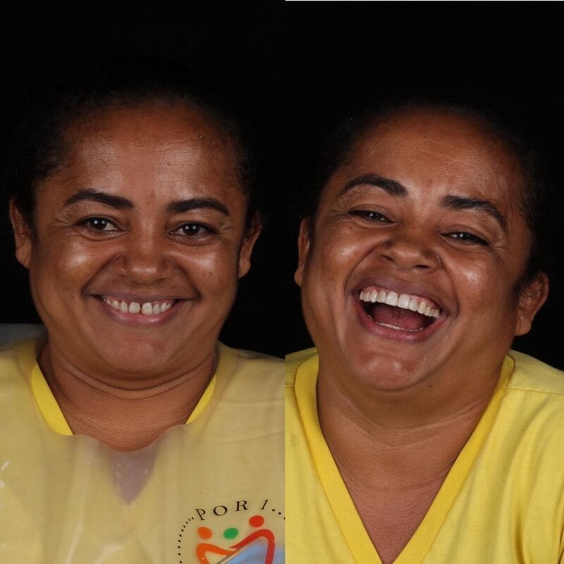 Фотография: Бразильский стоматолог помогает беднякам блистать белоснежной улыбкой №10 - BigPicture.ru