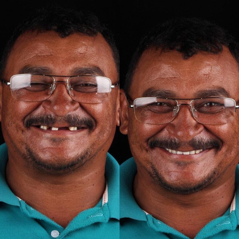 Фотография: Бразильский стоматолог помогает беднякам блистать белоснежной улыбкой №12 - BigPicture.ru