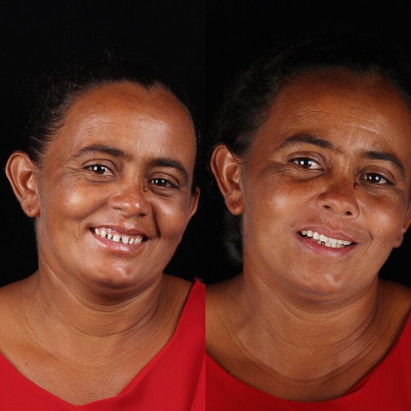 Фотография: Бразильский стоматолог помогает беднякам блистать белоснежной улыбкой №14 - BigPicture.ru