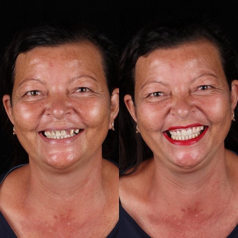 Фотография: Бразильский стоматолог помогает беднякам блистать белоснежной улыбкой №16 - BigPicture.ru