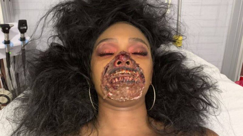 Фотография: Девушка с реалистичным гримом зомби ввела в заблуждение врачей №3 - BigPicture.ru