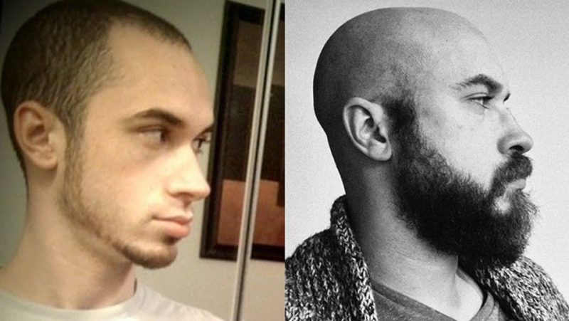 Фотография: 20 фотографий, которые доказывают, что борода может изменить мужчину до неузнаваемости №11 - BigPicture.ru