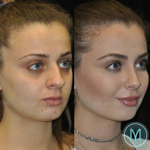 Фотография: Девушки до и после всего одного изменения во внешности №13 - BigPicture.ru