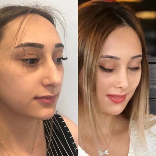 Фотография: Девушки до и после всего одного изменения во внешности №15 - BigPicture.ru
