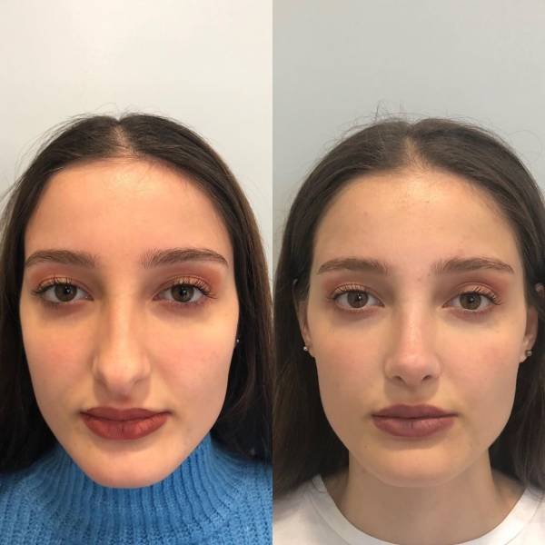 Фотография: Девушки до и после всего одного изменения во внешности №16 - BigPicture.ru