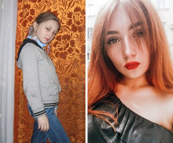 Фотография: А девочка созрела: 22 девушки показали, они изменились всего за несколько лет №19 - BigPicture.ru