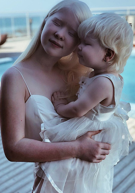 Фотография: Сестры-альбиносы из Казахстана завоевывают модельный мир №3 - BigPicture.ru