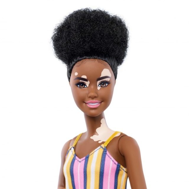 Фотография: Барби без волос, с витилиго и протезами: компания Mattel выпустит инклюзивных кукол №2 - BigPicture.ru