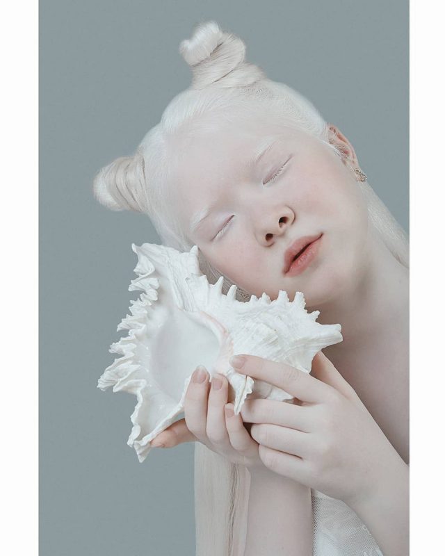 Фотография: Сестры-альбиносы из Казахстана завоевывают модельный мир №14 - BigPicture.ru