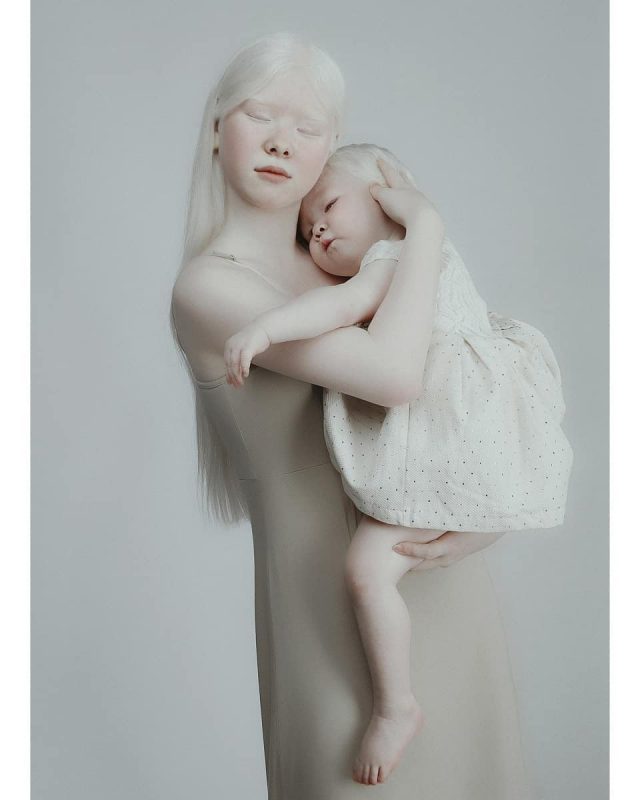 Фотография: Сестры-альбиносы из Казахстана завоевывают модельный мир №13 - BigPicture.ru