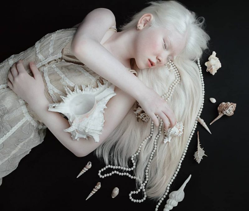 Фотография: Сестры-альбиносы из Казахстана завоевывают модельный мир №7 - BigPicture.ru