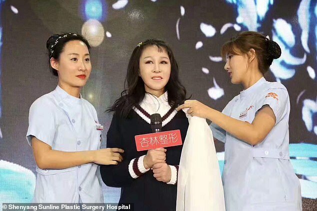 Фотография: Из бабушки в девочку: 15-летней китаянке с лицом старушки сделали операцию №2 - BigPicture.ru