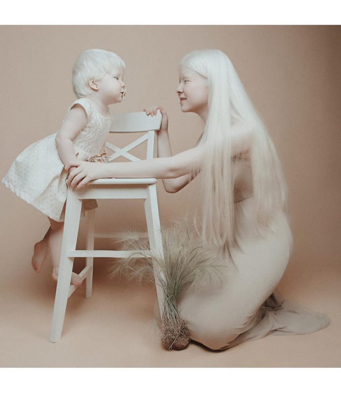 Фотография: Сестры-альбиносы из Казахстана завоевывают модельный мир №12 - BigPicture.ru