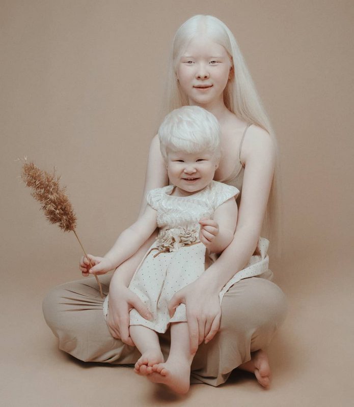 Фотография: Сестры-альбиносы из Казахстана завоевывают модельный мир №11 - BigPicture.ru