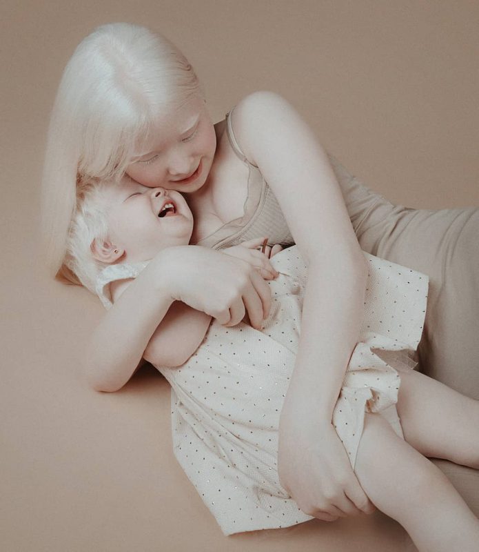 Фотография: Сестры-альбиносы из Казахстана завоевывают модельный мир №10 - BigPicture.ru