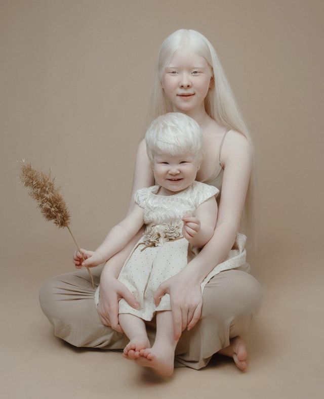 Фотография: Сестры-альбиносы из Казахстана завоевывают модельный мир №2 - BigPicture.ru
