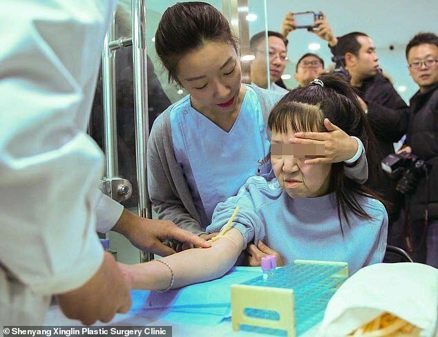 Фотография: Из бабушки в девочку: 15-летней китаянке с лицом старушки сделали операцию №8 - BigPicture.ru