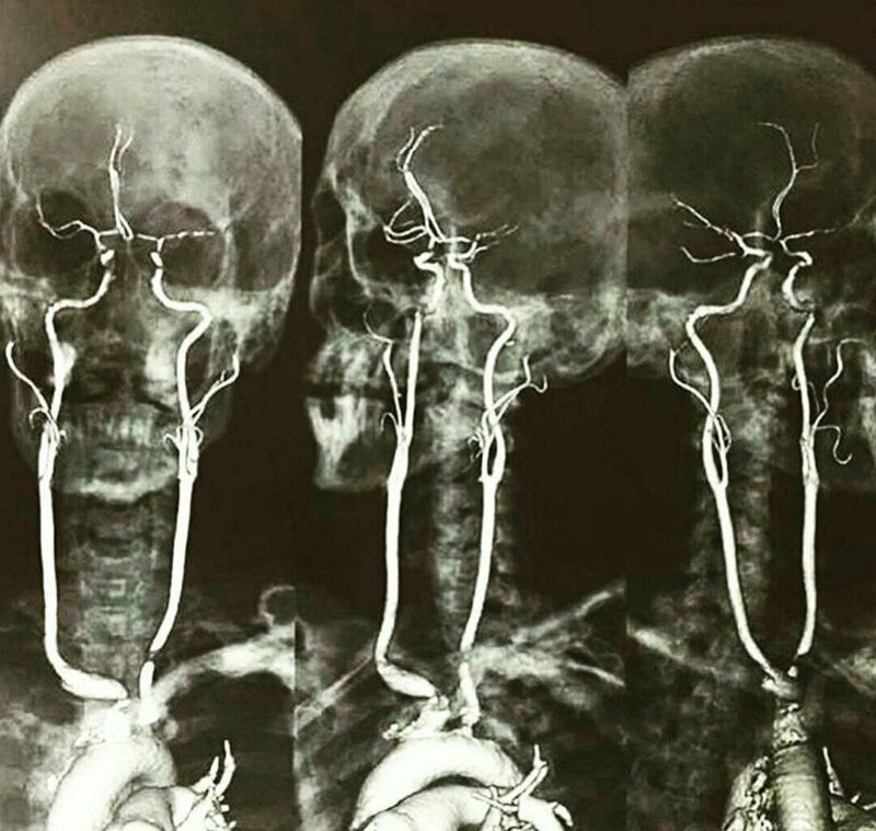 Фотография: Богатый внутренний мир: 17 рентгеновских снимков, которые врачи не сразу развидят №3 - BigPicture.ru