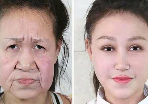 Из бабушки в девочку: 15-летней китаянке с лицом старушки сделали операцию