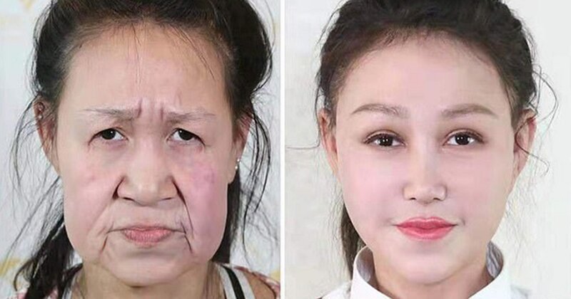 Фотография: Из бабушки в девочку: 15-летней китаянке с лицом старушки сделали операцию №1 - BigPicture.ru