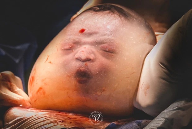 Фотография: Самые впечатляющие фотографии с конкурса Birth Photo Competition 2020 №6 - BigPicture.ru
