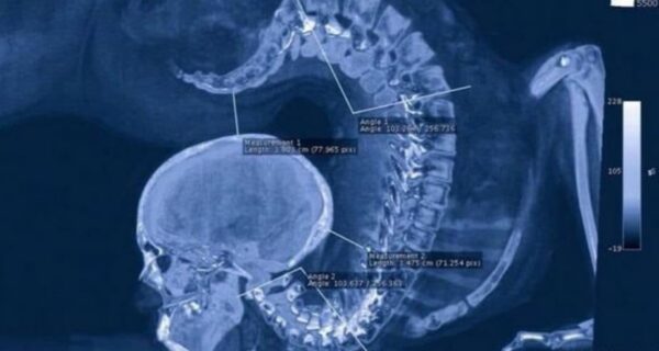 15 очень странных и страшных фото реально существующих вещей