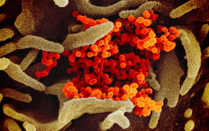 Фотография: Ученые показали, как выглядит под микроскопом коронавирус Covid-19 №4 - BigPicture.ru