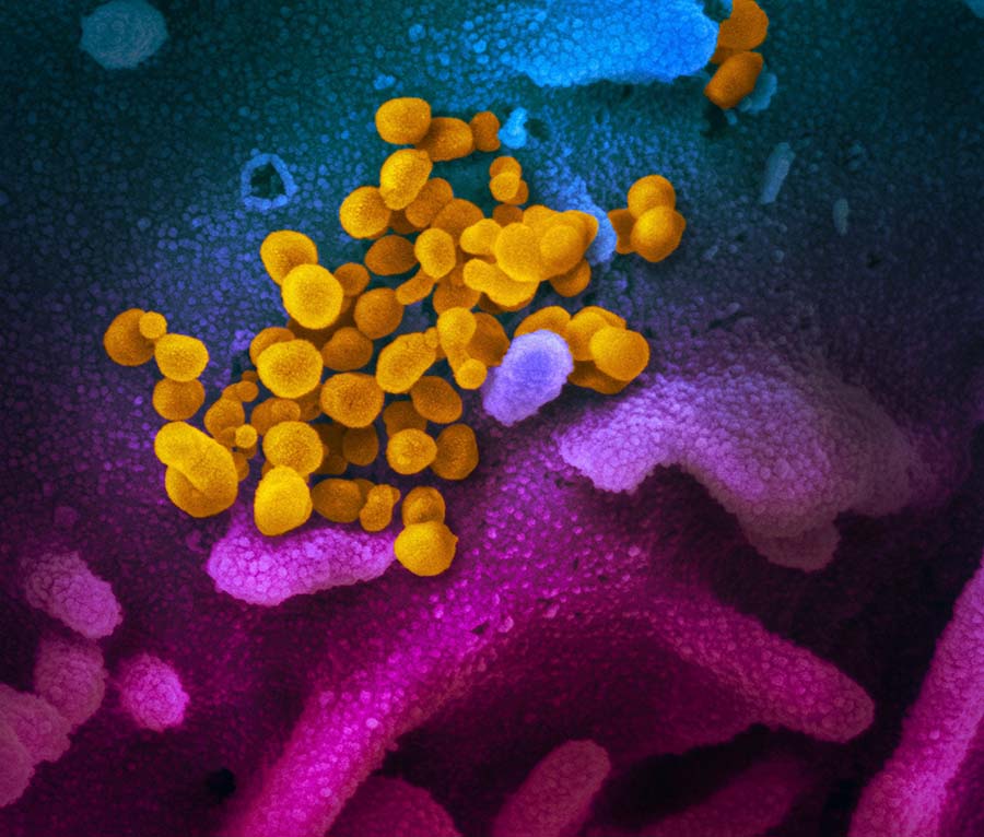 Фотография: Ученые показали, как выглядит под микроскопом коронавирус Covid-19 №2 - BigPicture.ru