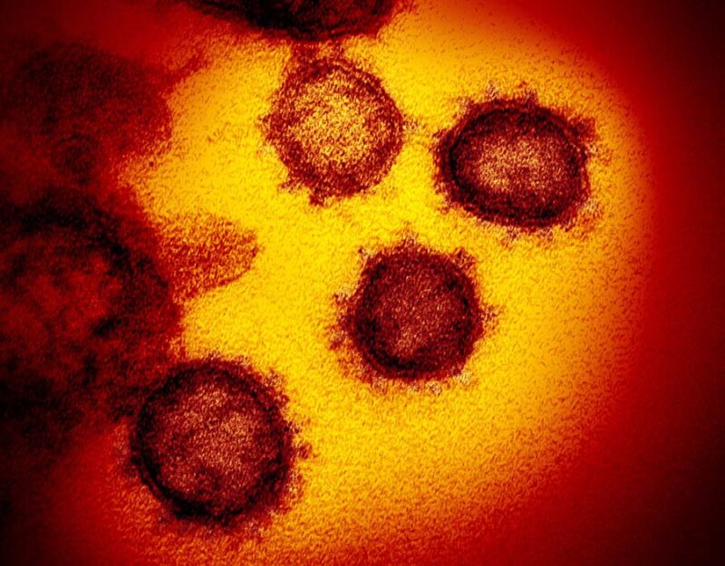 Фотография: Ученые показали, как выглядит под микроскопом коронавирус Covid-19 №3 - BigPicture.ru
