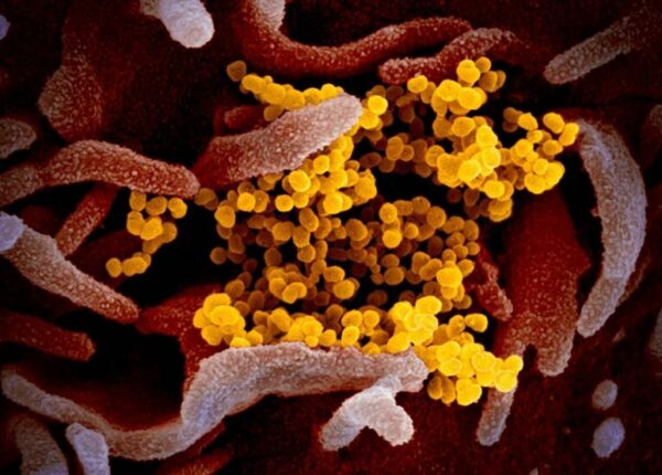 Ученые показали, как выглядит под микроскопом коронавирус Covid-19