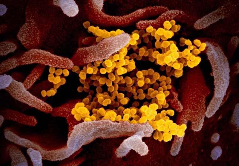 Фотография: Ученые показали, как выглядит под микроскопом коронавирус Covid-19 №1 - BigPicture.ru