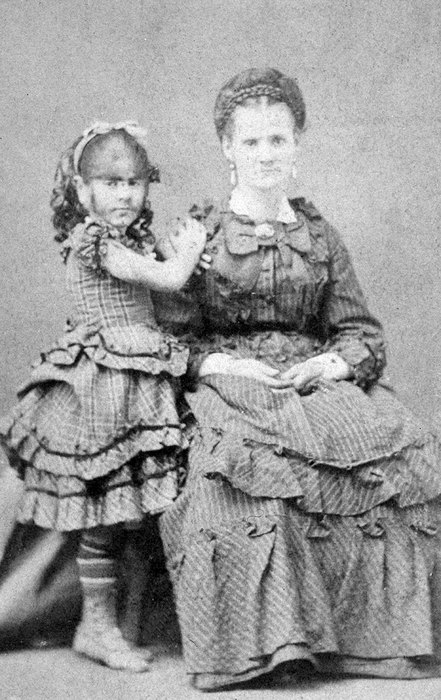 Бородатая женщина Энни Джонс со своей матерью