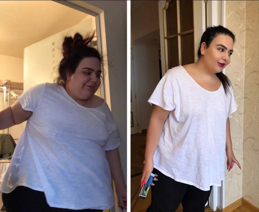 Фотография: История похудения Софии Броян, веселой блогерши из Тюмени, которая избавилась за год от 100 кг №3 - BigPicture.ru