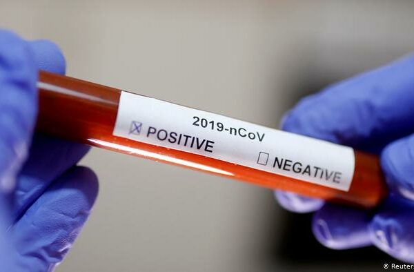Какие шансы заразиться коронавирусом для людей с разными группами крови