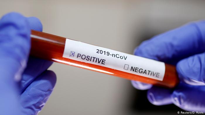 Фотография: Какие шансы заразиться коронавирусом для людей с разными группами крови №1 - BigPicture.ru