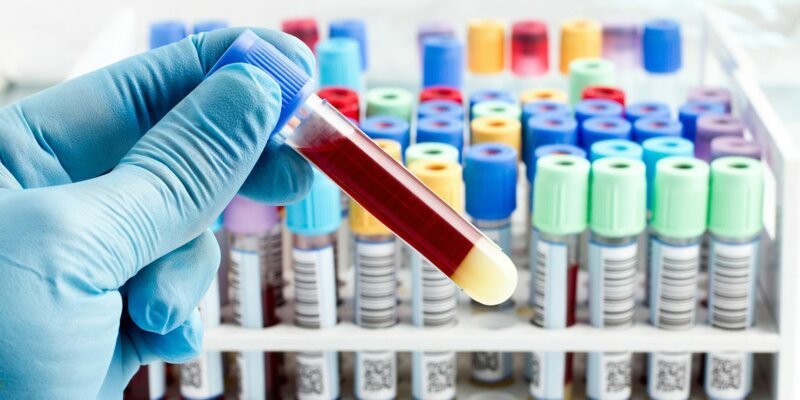 Фотография: Какие шансы заразиться коронавирусом для людей с разными группами крови №4 - BigPicture.ru