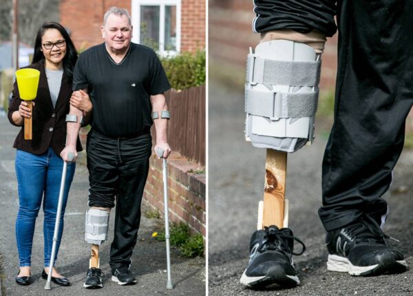 Новая нога своими руками: женщина сделала мужу протез из подручных материалов