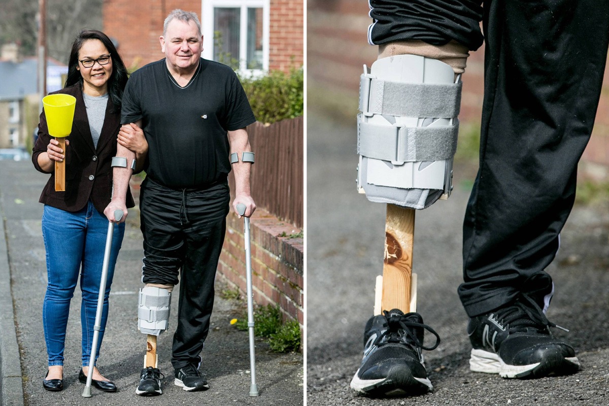 Фотография: Новая нога своими руками: женщина сделала мужу протез из подручных материалов №1 - BigPicture.ru