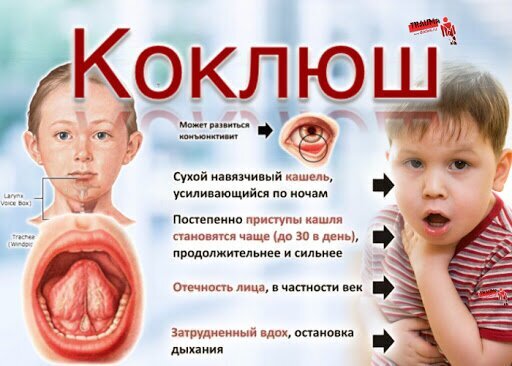 Фотография: Братство, объединенное шрамами: от каких болезней делают прививки №7 - BigPicture.ru