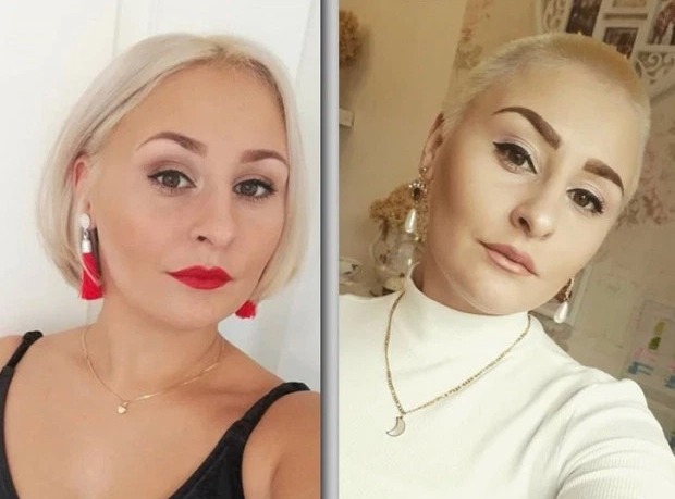 Фотография: Нет волос — нет проблем: почему женщины бреются наголо во время карантина №1 - BigPicture.ru