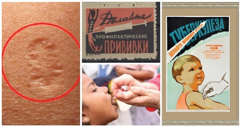 Фотография: Братство, объединенное шрамами: от каких болезней делают прививки №1 - BigPicture.ru