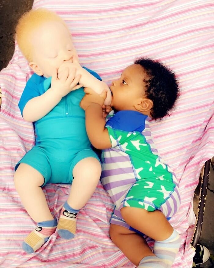 Фотография: В чем секрет близнецов с разным цветом кожи из Нигерии №6 - BigPicture.ru