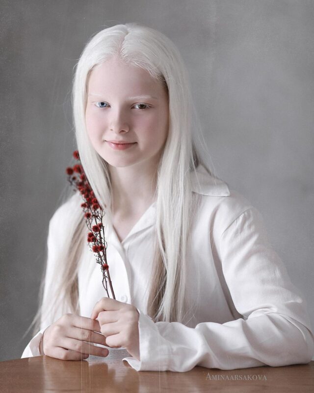 Фотография: Девочка-альбинос из Чечни поразила своей уникальной внешностью №5 - BigPicture.ru