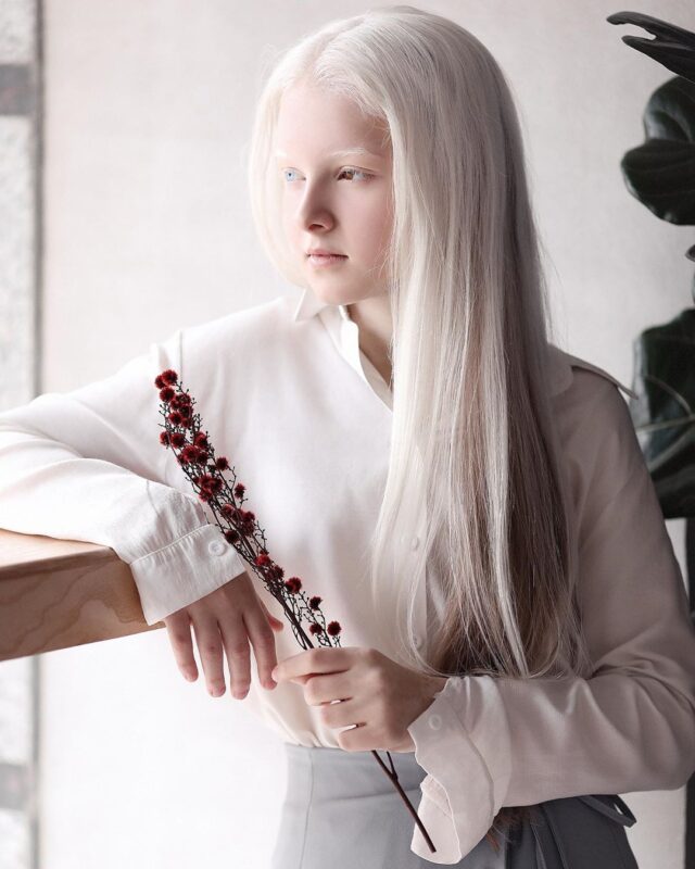 Фотография: Девочка-альбинос из Чечни поразила своей уникальной внешностью №8 - BigPicture.ru