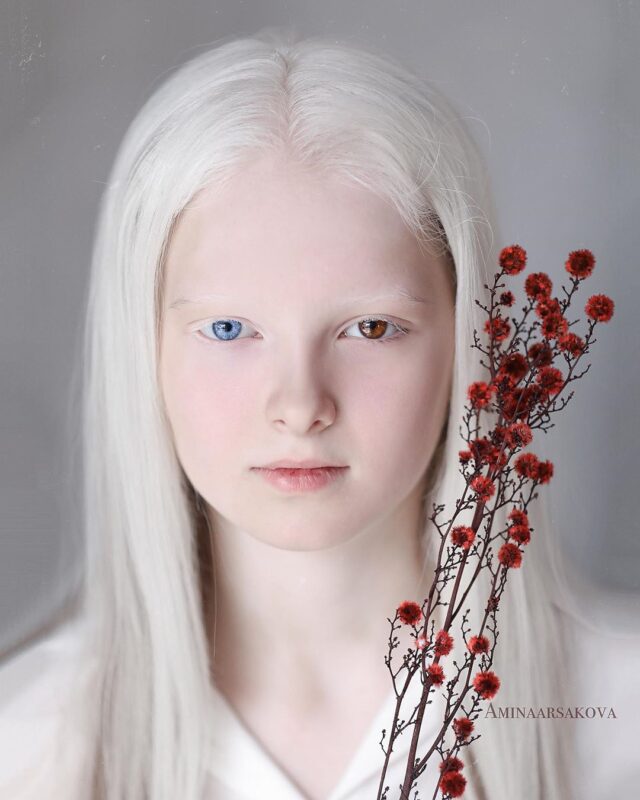 Фотография: Девочка-альбинос из Чечни поразила своей уникальной внешностью №3 - BigPicture.ru