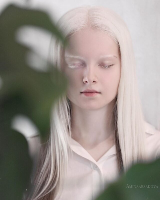 Фотография: Девочка-альбинос из Чечни поразила своей уникальной внешностью №9 - BigPicture.ru