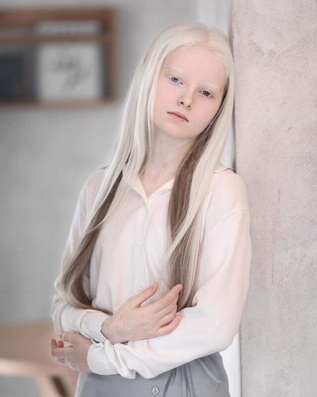 Фотография: Девочка-альбинос из Чечни поразила своей уникальной внешностью №6 - BigPicture.ru