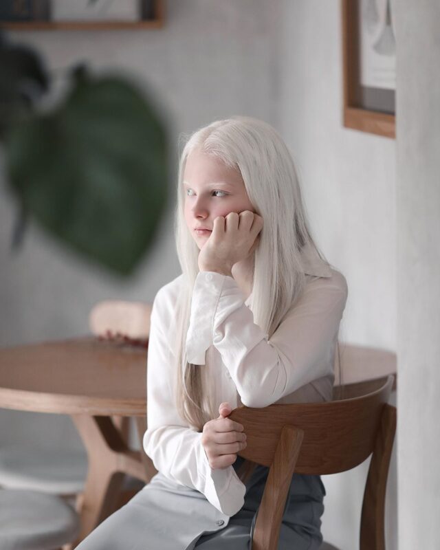 Фотография: Девочка-альбинос из Чечни поразила своей уникальной внешностью №4 - BigPicture.ru