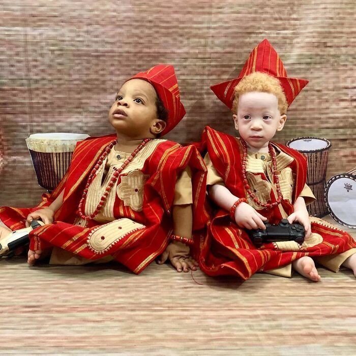 Фотография: В чем секрет близнецов с разным цветом кожи из Нигерии №14 - BigPicture.ru