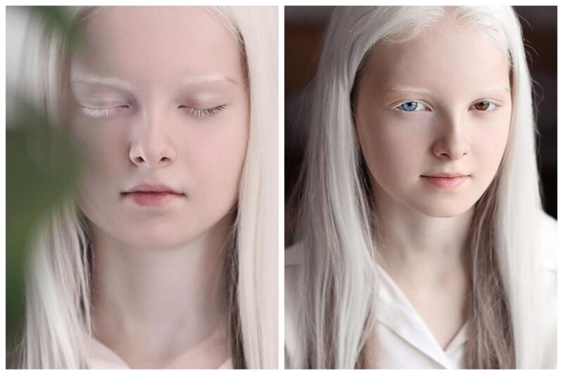 Фотография: Девочка-альбинос из Чечни поразила своей уникальной внешностью №1 - BigPicture.ru